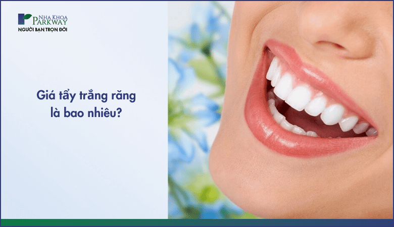 Giá tẩy trắng răng là bao nhiêu