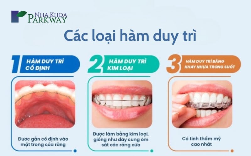 Các loại hàm duy trì khi niềng răng