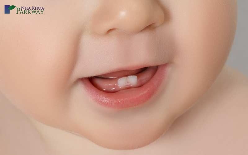 Hình ảnh trẻ mọc hai răng cửa hàm dưới