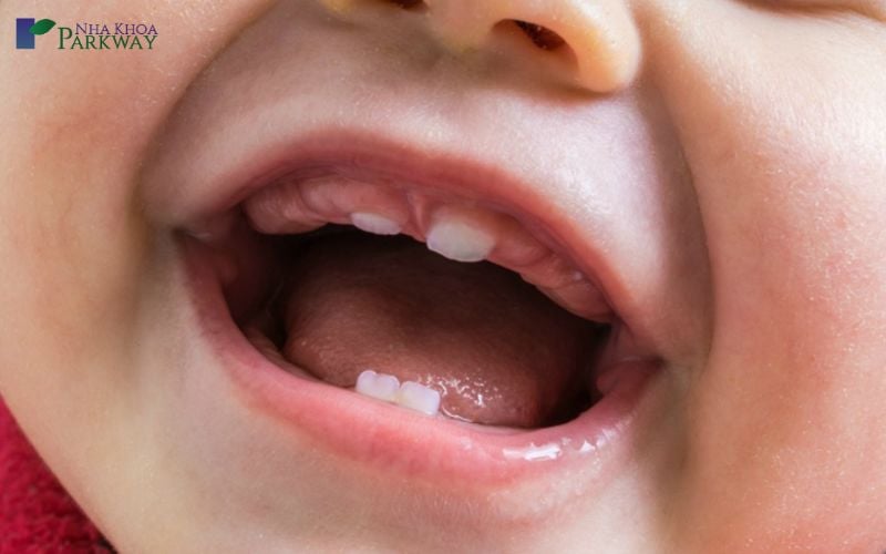Hình ảnh trẻ em đang bắt đầu mọc răng cửa cả hàm trên và dưới