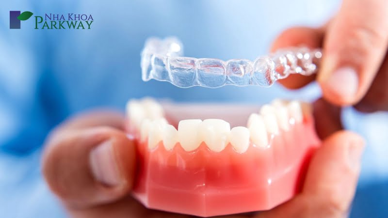 Cách điều trị hô xương ổ răng như thế nào?
