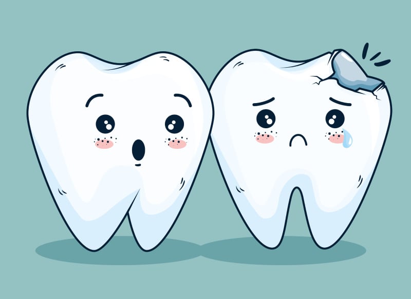 Ảnh so sánh giữa chiếc răng bình thường và chiếc răng bị mẻ