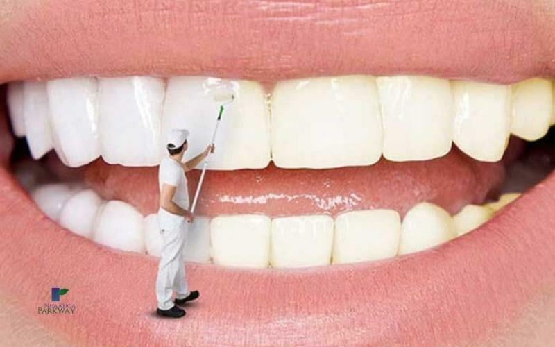 Lấy cao răng, vệ sinh đánh bóng sẽ làm răng trông thẩm mỹ và tự tin hơn 
