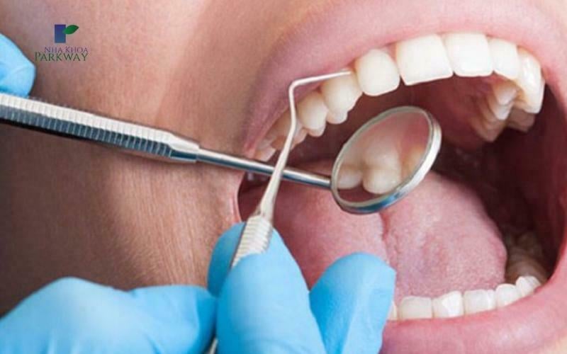 Nha sĩ sử dụng gương và tăm nước nha khoa để lấy cao răng
