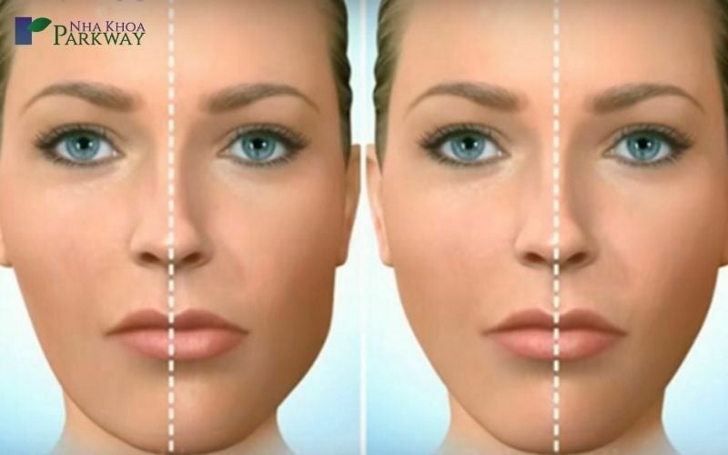 Hình ảnh phân biệt giữa khuôn mặt lệch và khuôn mặt cân xứng