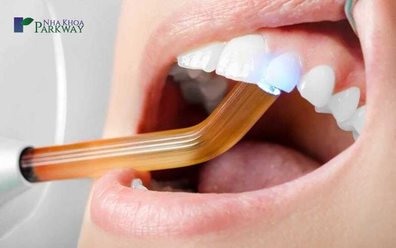 Dùng dụng cụ hàn y tế để trám răng mẻ