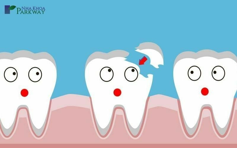 So sánh chiếc răng bình thường và răng bị mẻ