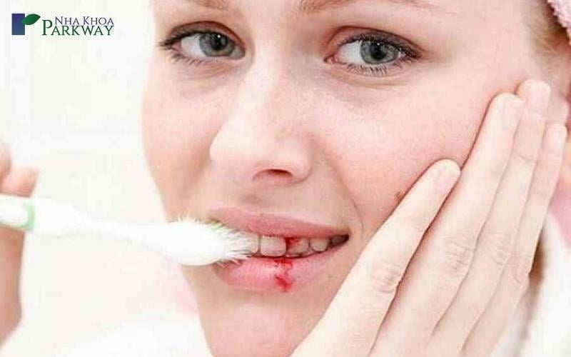 Người phụ nữ bị chảy máu khi đánh răng