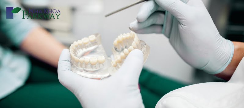 Răng giả tháo lắp có những ưu điểm nào?