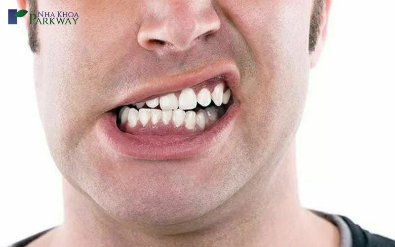 Hình ảnh người đàn ông nghiến răng