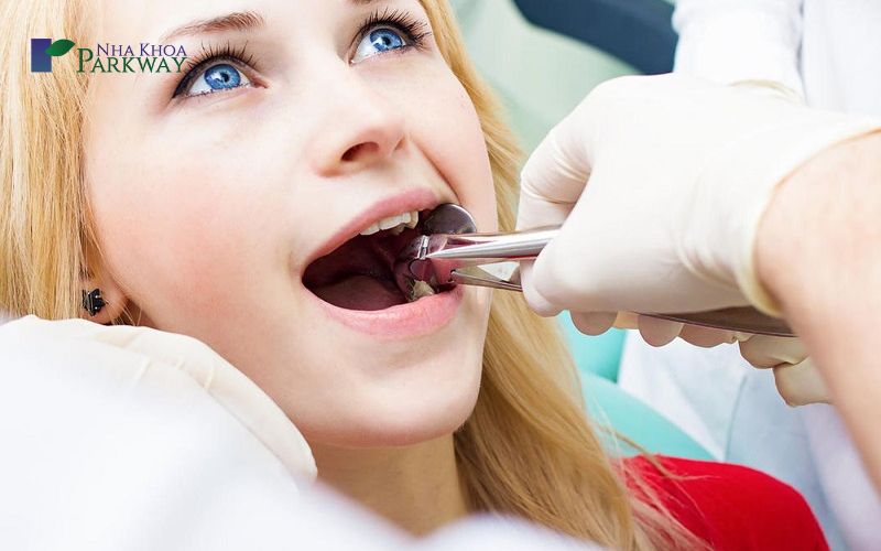 Quy trình nhổ răng cấm chuẩn nha khoa