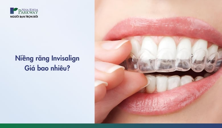 Niềng răng Invisalign giá bao nhiêu - 1