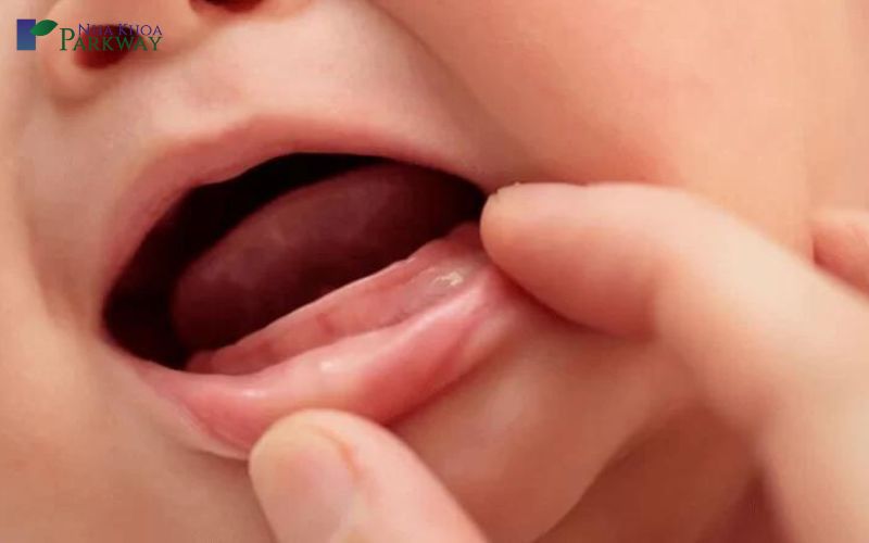 em bé sơ sinh có dấu hiệu mọc răng sữa