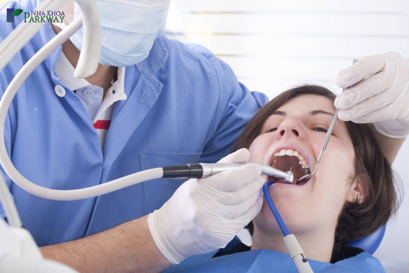 phương pháp trám răng là gì