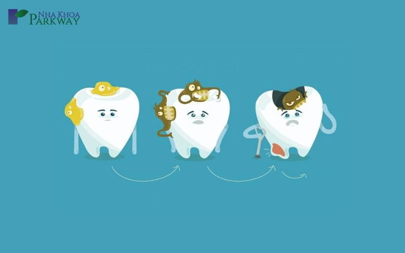 Nguyên nhân răng bọc sứ bị viêm tủy