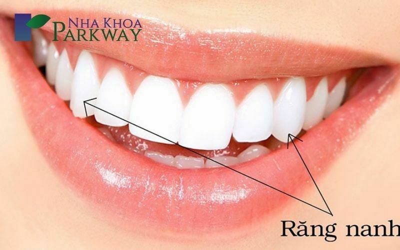 Mô tả vị trí chính xác của răng nanh