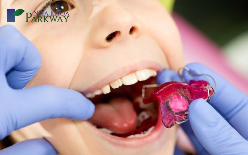 Răng thưa ở trẻ em có khắc phục được hay không? Có nên điều trị?