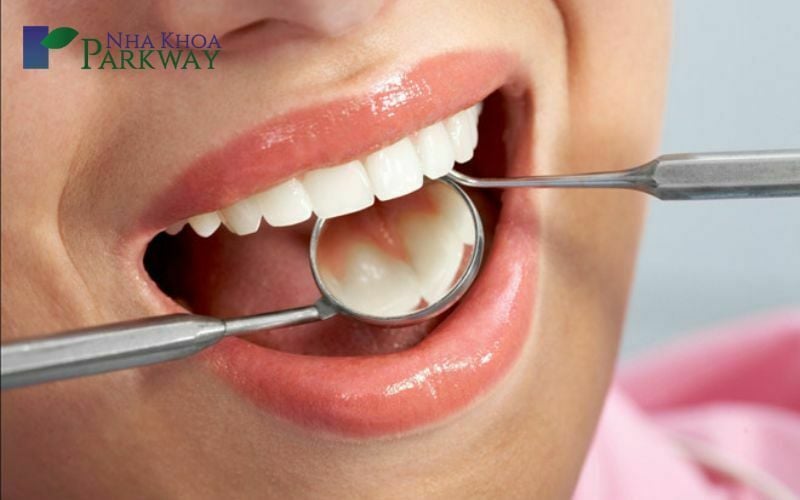 Sử dụng gương và công cụ nha khoa để kiểm tra mặt trong của răng