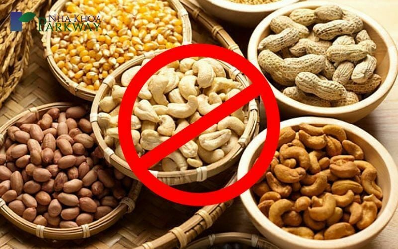 Một số loại hạt không nên ăn sau khi trám răng