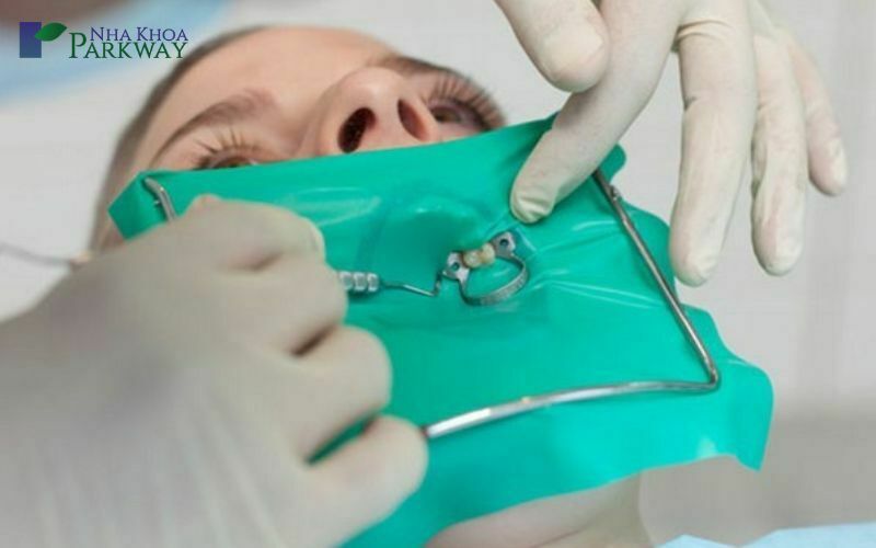 Bác sĩ đặt đế cao su cho răng sâu để tách răng ra khỏi nướu và răng miệng