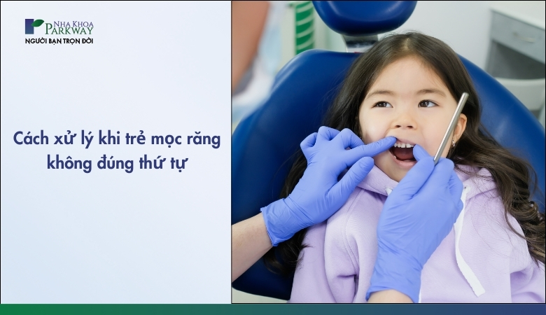 Trẻ mọc răng không đúng thứ tự