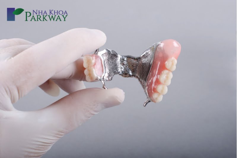 Làm răng giả bằng phương pháp làm hàm tháo lắp mất bao lâu?