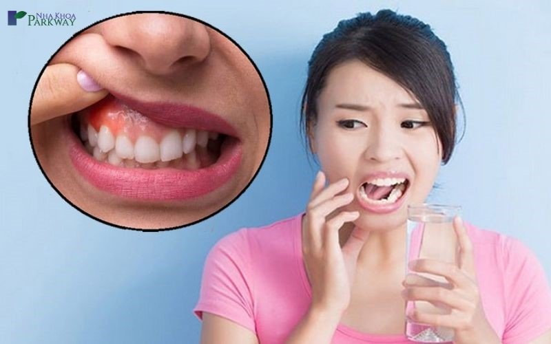 Viêm ở chân răng có gây nguy hiểm tới sức khỏe người bệnh không?