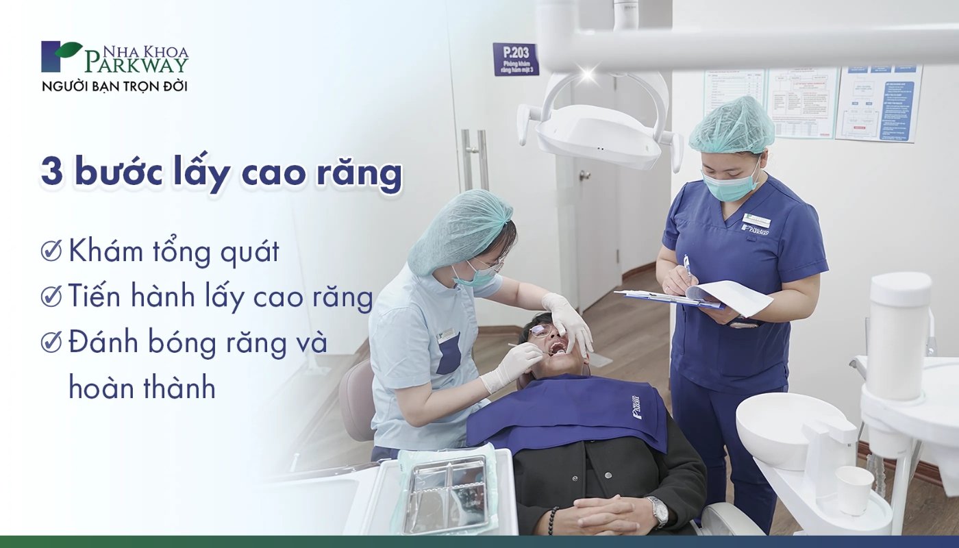 3 bước lấy cao răng