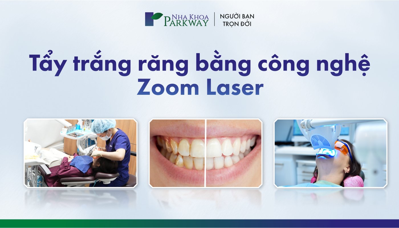 tẩy trắng răng zoom laser - 1