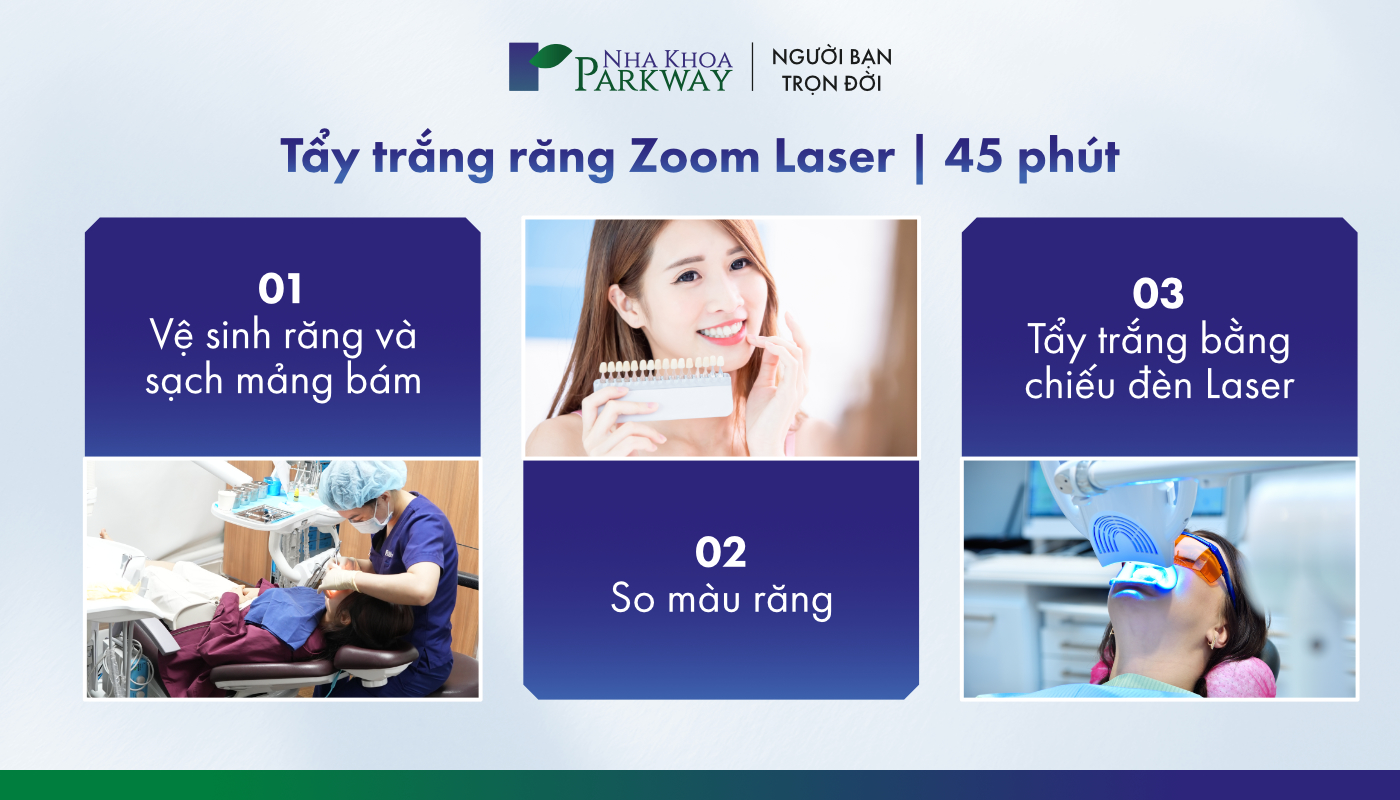 tẩy trắng răng zoom laser -3