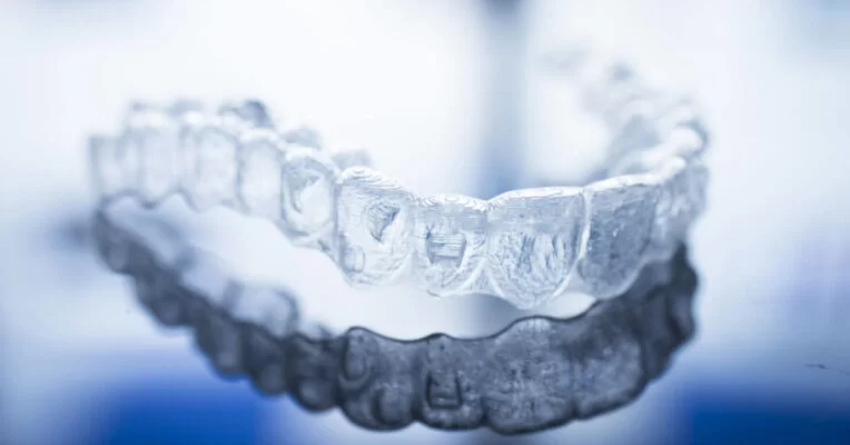 Khay niềng răng trong suốt được thiết kế dựa trên đặc điểm răng của mỗi bệnh nhân