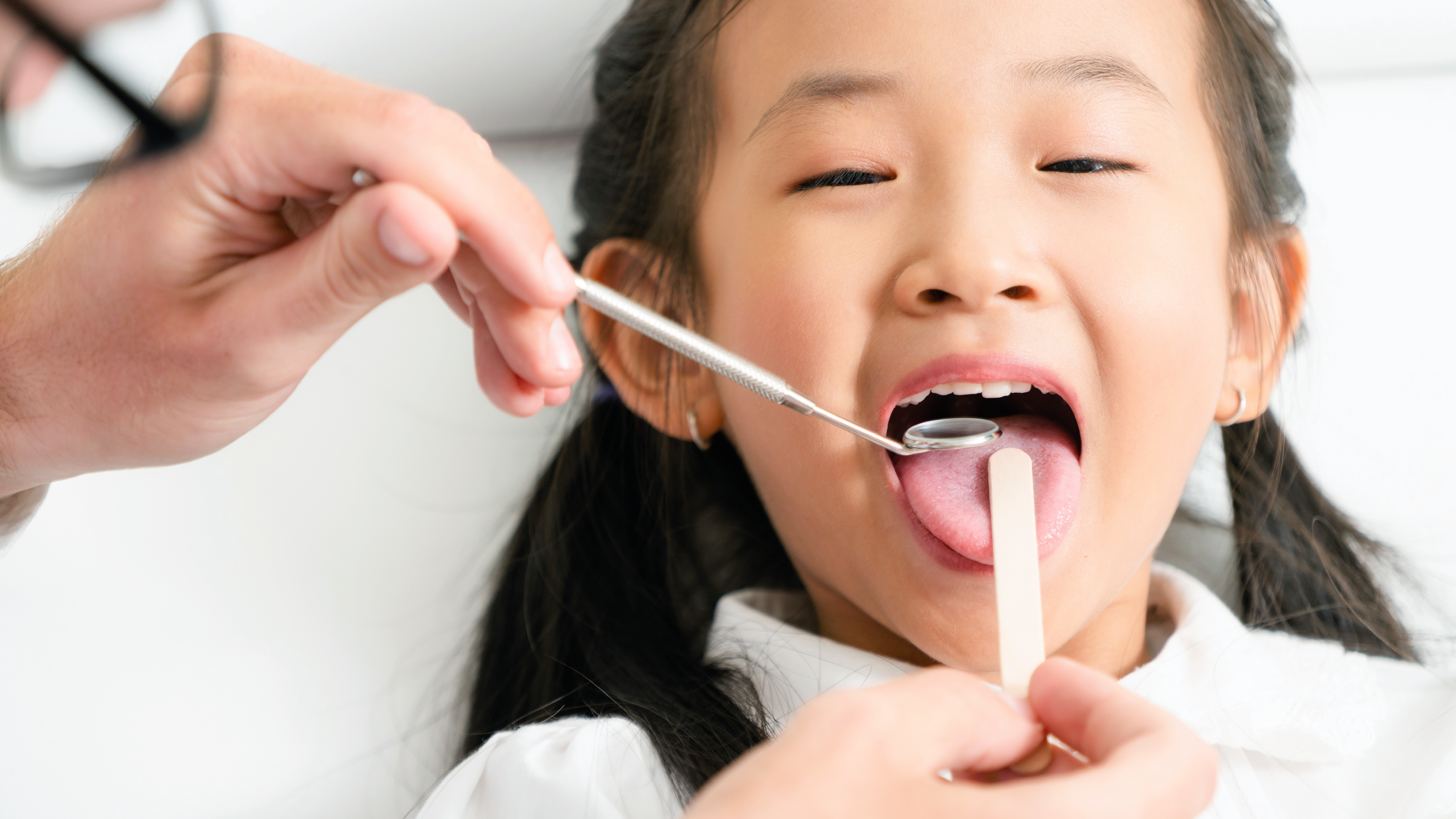 Bác sĩ khám răng sữa hàm trên cho em bé để đưa ra giải pháp bọc mão răng phù hợp