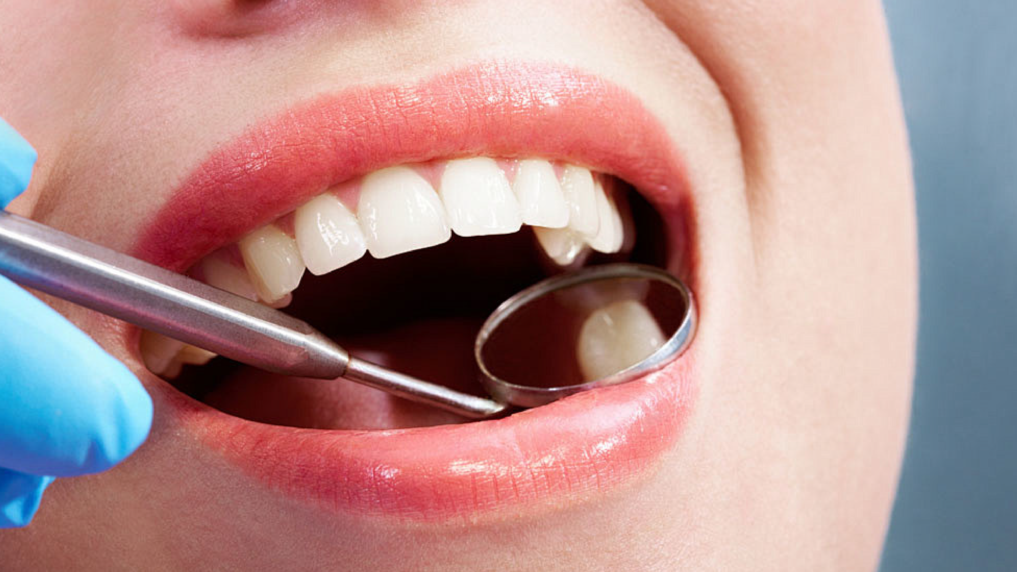 Bác sĩ sử dụng gương nha để thăm khám xác định vị trí răng cần nhổ