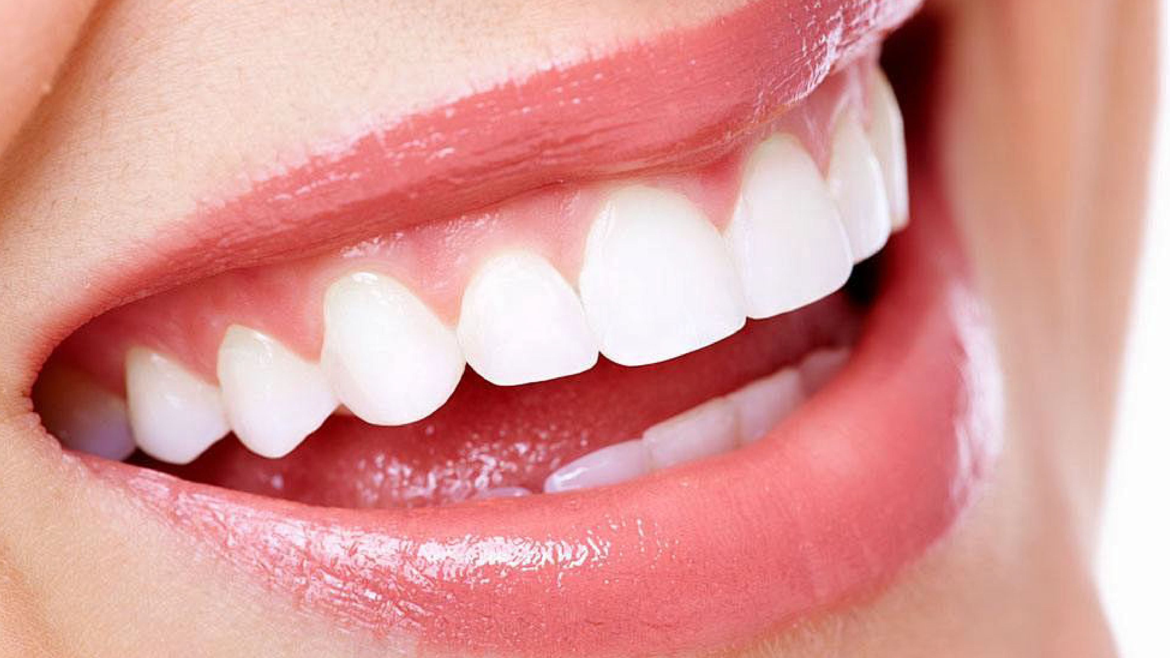 Tẩy răng trắng sang mang lại cho bạn nụ cười tự tin và rạng rỡ hơn