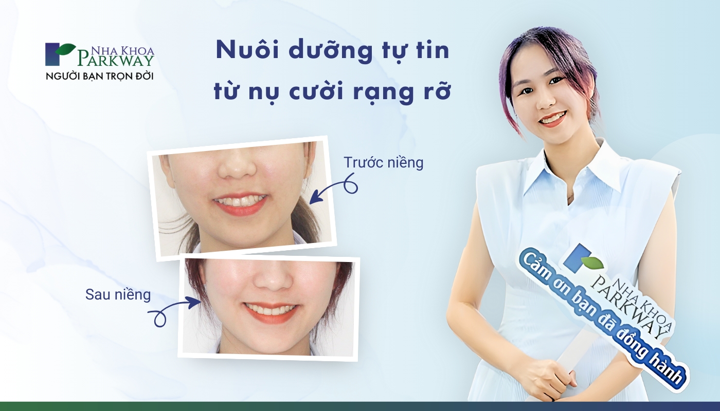 Hình ảnh cô gái trước và sau khi niềng răng, nuôi dưỡng tự tin từ nụ cười rạng rỡ