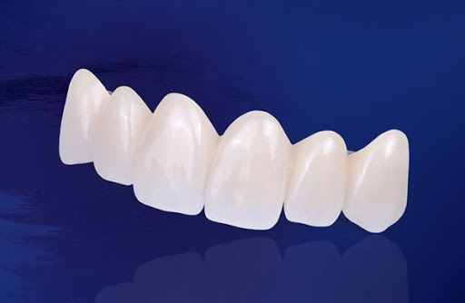 Răng sứ Zirconia có thẩm mỹ vượt trội