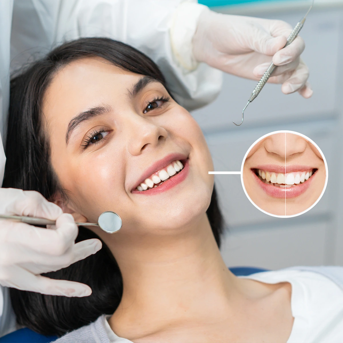 Hình ảnh khách hàng sử dụng dịch vị nha khoa thẩm mỹ , hiệu quả trước và sau