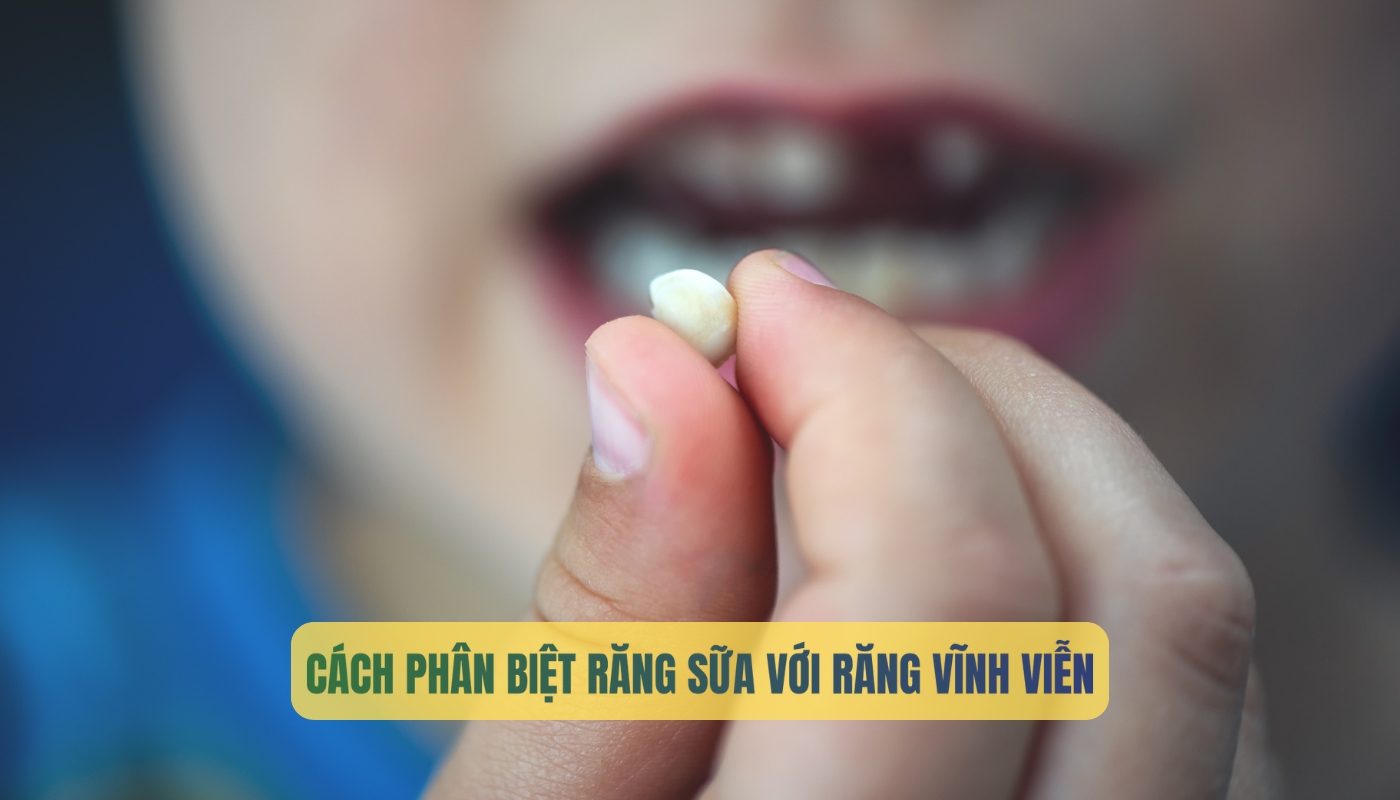 Cách phân biệt răng sữa và răng vĩnh viễn