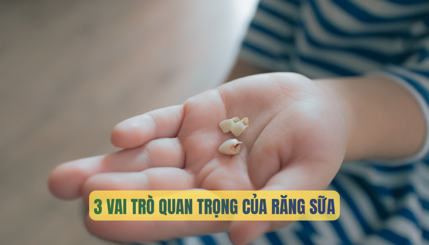 Răng sữa là gì? Có vai trò như thế nào đối với sự phát triển của trẻ