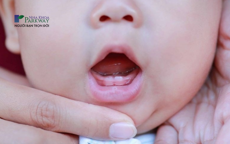 Hình ảnh trẻ mọc những chiếc răng sữa đầu tiên ở hàm dưới