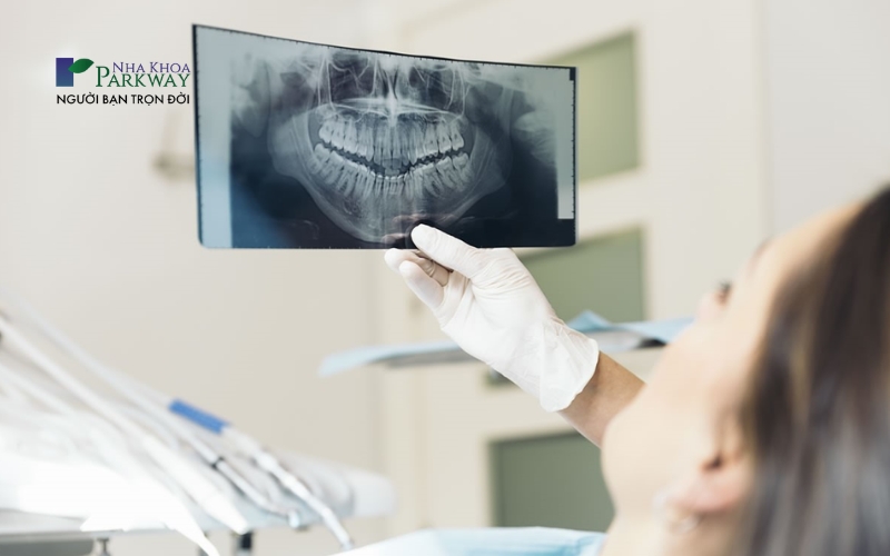 Hình ảnh bác sĩ cho bệnh nhân xem ảnh chụp xương hàm trước khi nhổ răng khôn