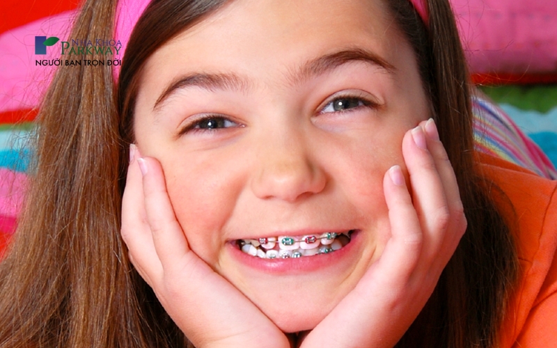 Hình ảnh bé gái đeo niềng răng mắc cài kim loại