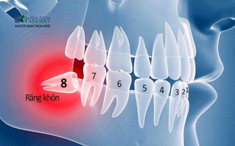 Răng khôn còn được gọi là răng số 8, mọc sau cùng trên hàm