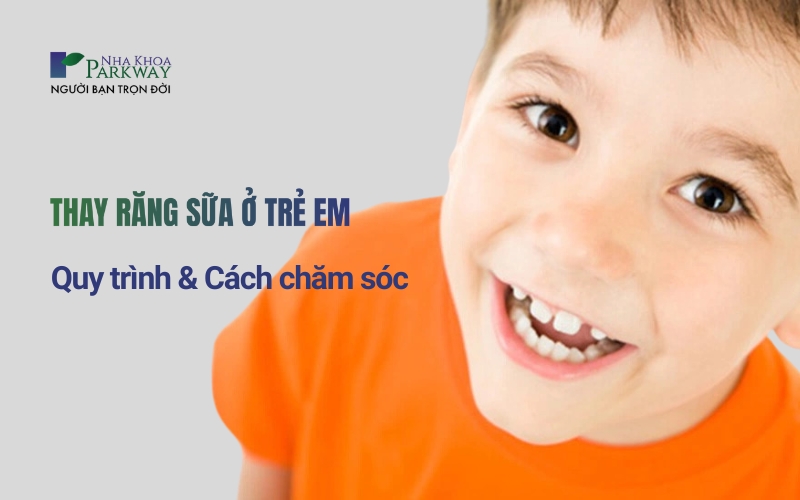 Banner chứa hình ảnh bé trai và dòng tiêu đề thay răng sữa ở trẻ em, quy trình và cách chăm sóc