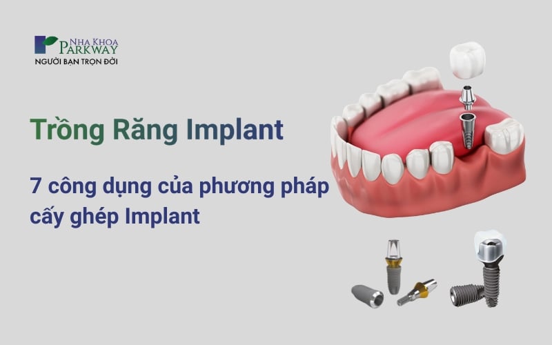 Banner chứa hình ảnh hàm răng mô phỏng trồng Implant và nội dung 7 công dụng của phương pháp cấy ghép Implant