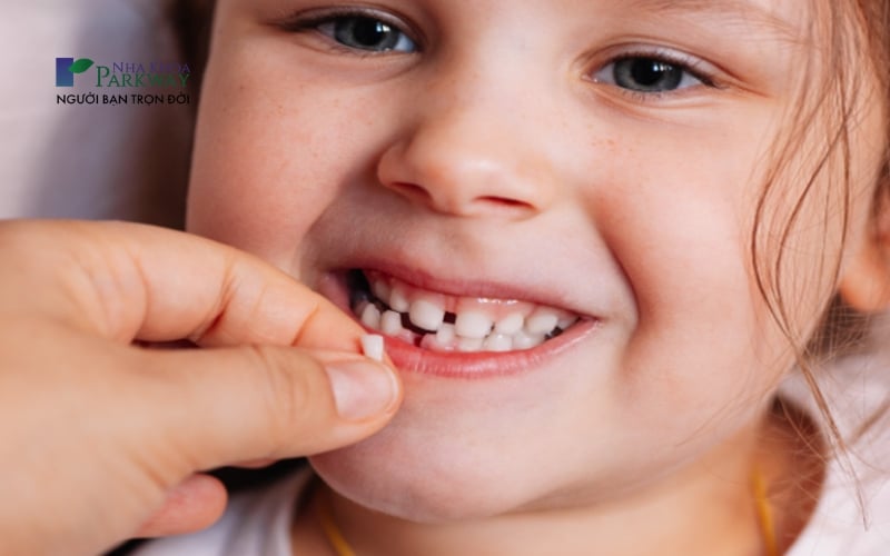 Vai trò của răng sữa là hướng dẫn vị trí cho răng vĩnh viễn mọc không bị xô lệch