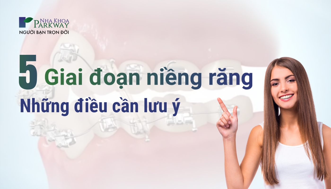 5 giai đoạn niềng răng và những điều cần lưu ý