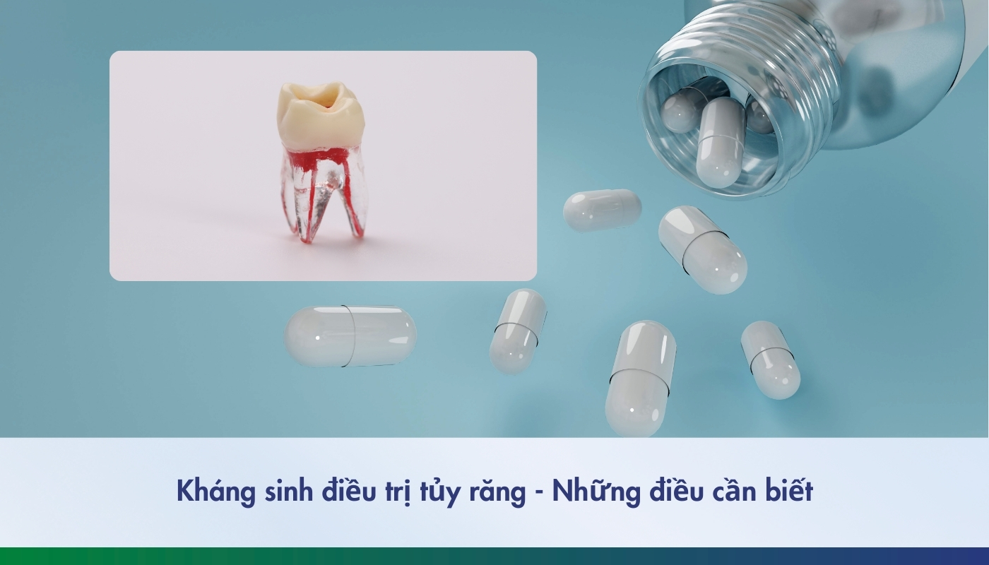 Thuốc kháng sinh điều trị viêm tủy răng