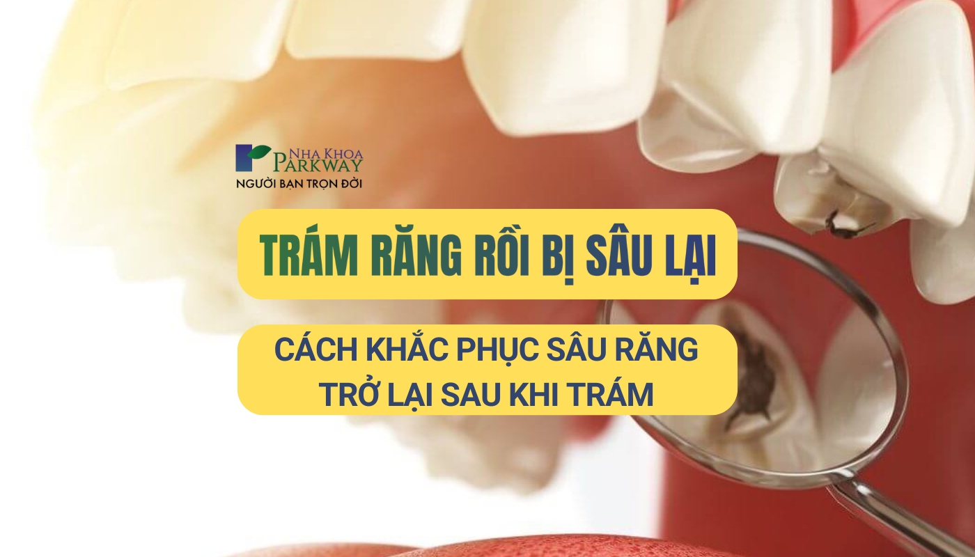 Trám răng rồi bị sâu lại, cách khắc phục hiệu quả