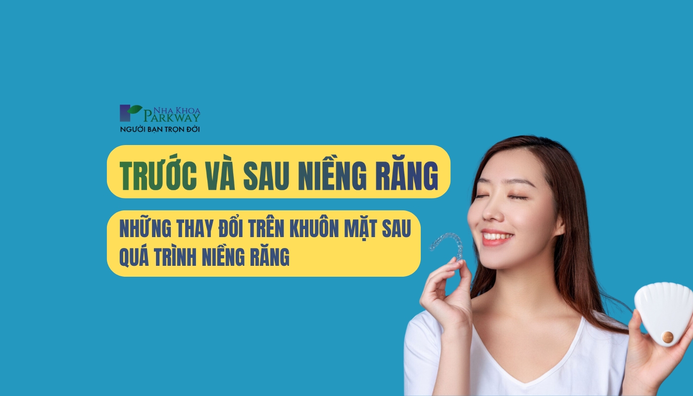 Những thay đổi trên khuôn mặt sau niềng răng